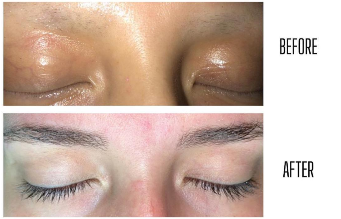 Lashes/brows enhancer
